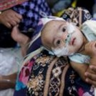 Emergency jabs after 100 children die of suspected measles in a month in Bangladesh