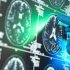 Report suggests 'breakthrough' Alzheimer's drugs unlikely to benefit patients